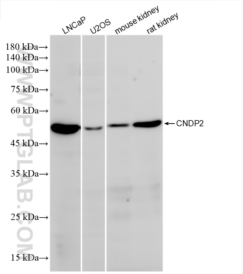 Western Blot (WB) analysis of various lysates using CNDP2 Recombinant antibody (84924-7-RR)