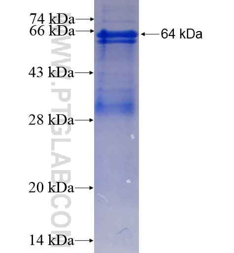 CNDP2 fusion protein Ag6684 SDS-PAGE