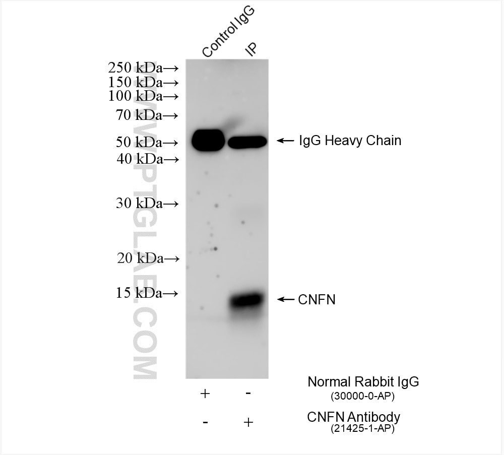 IP experiment of HK-2 using 21425-1-AP (same clone as 21425-1-PBS) Immunoprecipitation (IP) experiment of HK-2 cells using CNFN Polyclonal antibody (21425-1-AP)