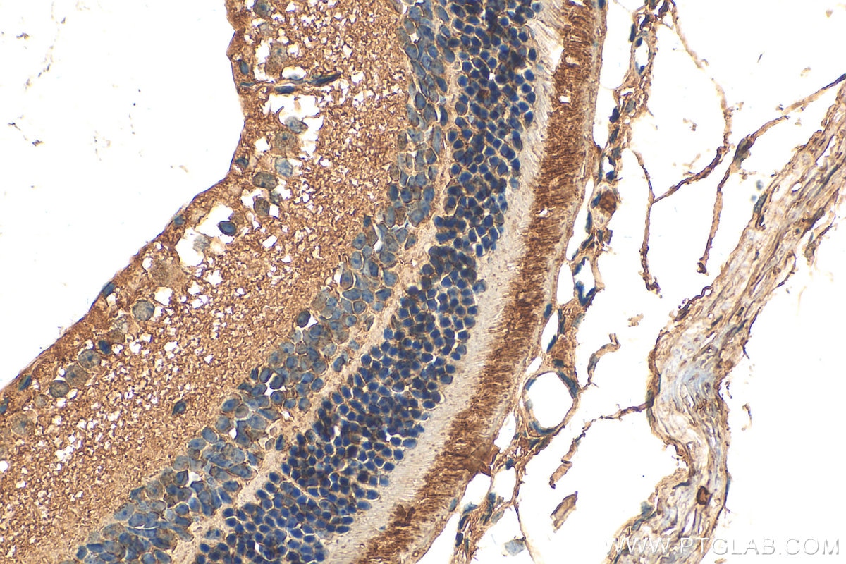 Immunohistochemistry (IHC) staining of mouse eye tissue using CNGA3 Polyclonal antibody (21657-1-AP)