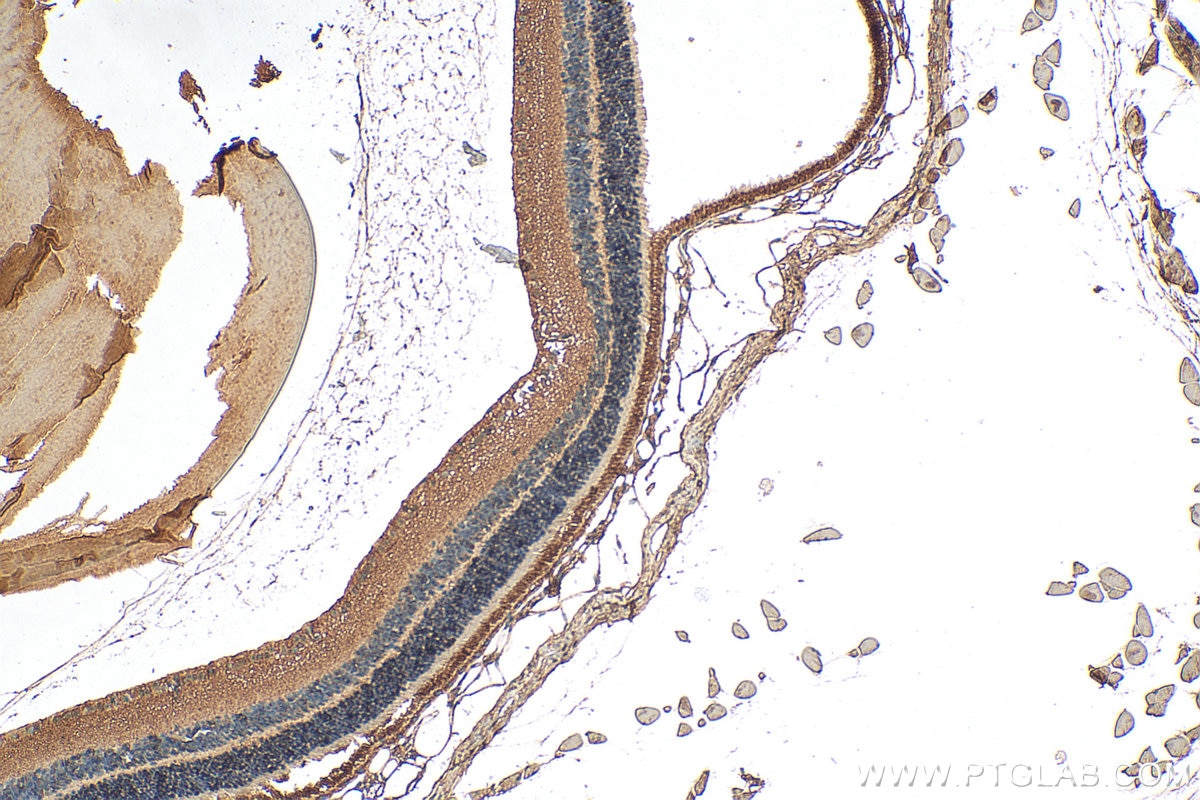 Immunohistochemistry (IHC) staining of mouse eye tissue using CNGA3 Polyclonal antibody (21657-1-AP)