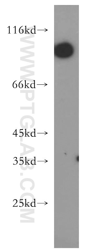 Western Blot (WB) analysis of HEK-293 cells using CNGA3 Polyclonal antibody (21657-1-AP)