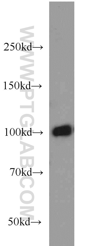 Western Blot (WB) analysis of HEK-293 cells using CNGA3 Polyclonal antibody (21657-1-AP)