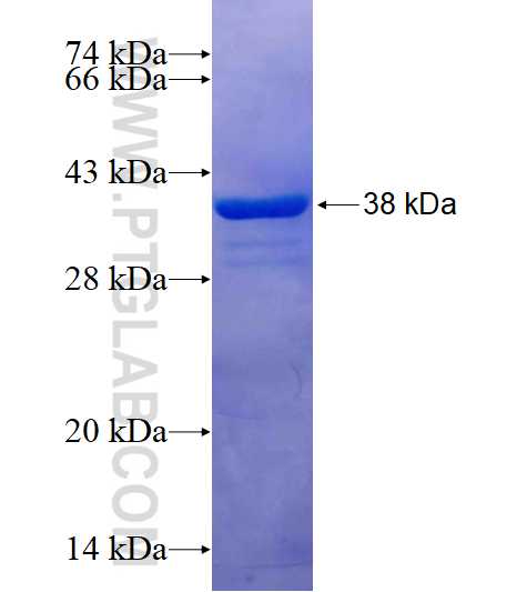 CNGA3 fusion protein Ag16385 SDS-PAGE