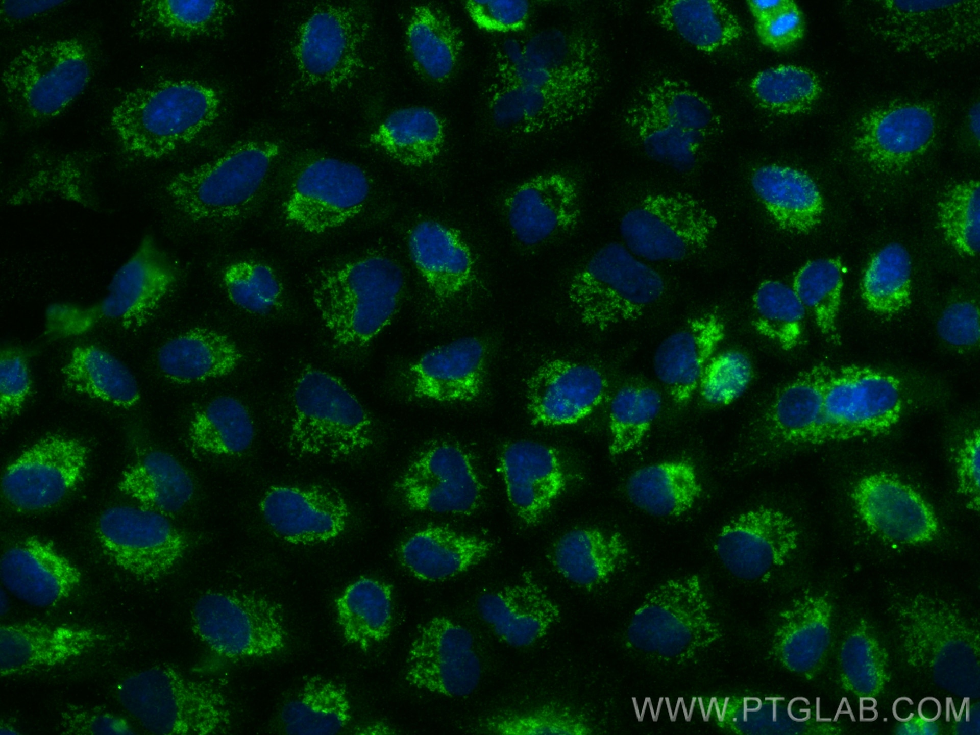 Immunofluorescence (IF) / fluorescent staining of A549 cells using CNIH2 Polyclonal antibody (14260-1-AP)