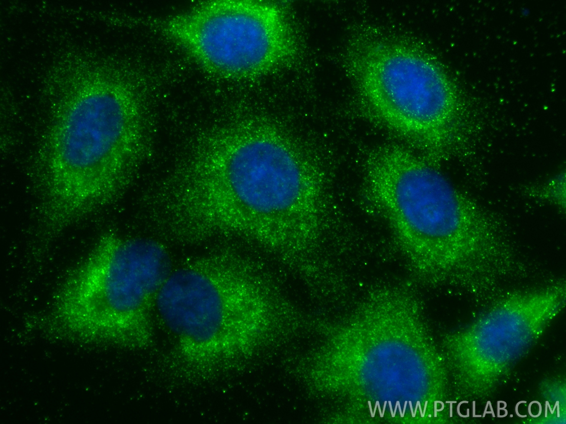 Immunofluorescence (IF) / fluorescent staining of A549 cells using CNIH2 Polyclonal antibody (14260-1-AP)