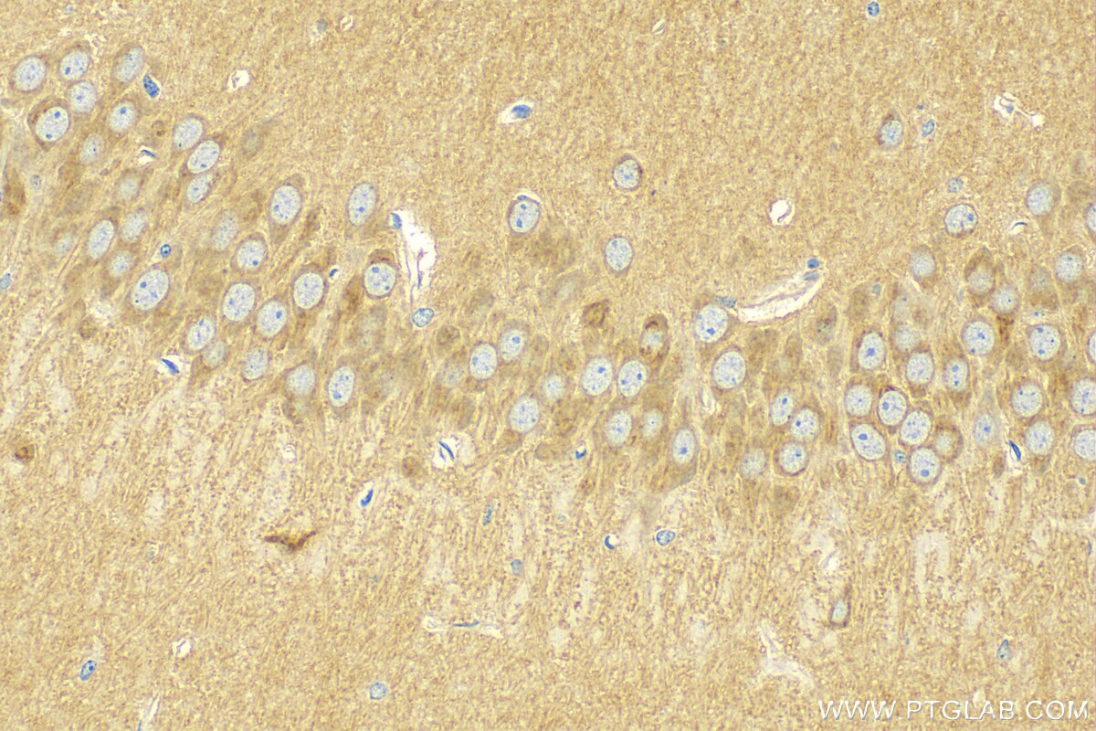 Immunohistochemistry (IHC) staining of mouse brain tissue using CNIH2 Polyclonal antibody (14260-1-AP)