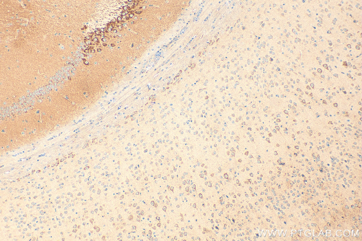 Immunohistochemistry (IHC) staining of mouse brain tissue using CNIH2 Polyclonal antibody (14260-1-AP)
