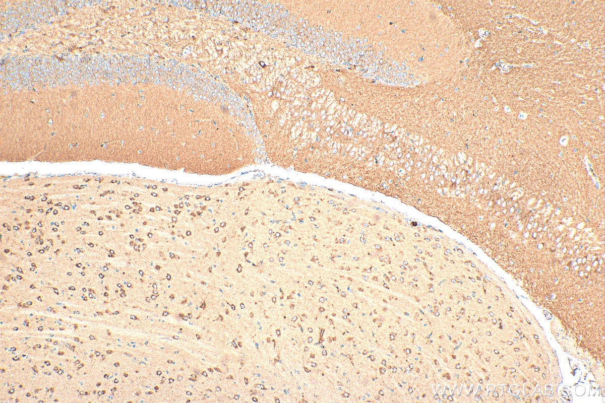 Immunohistochemistry (IHC) staining of mouse brain tissue using CNIH2 Polyclonal antibody (14260-1-AP)