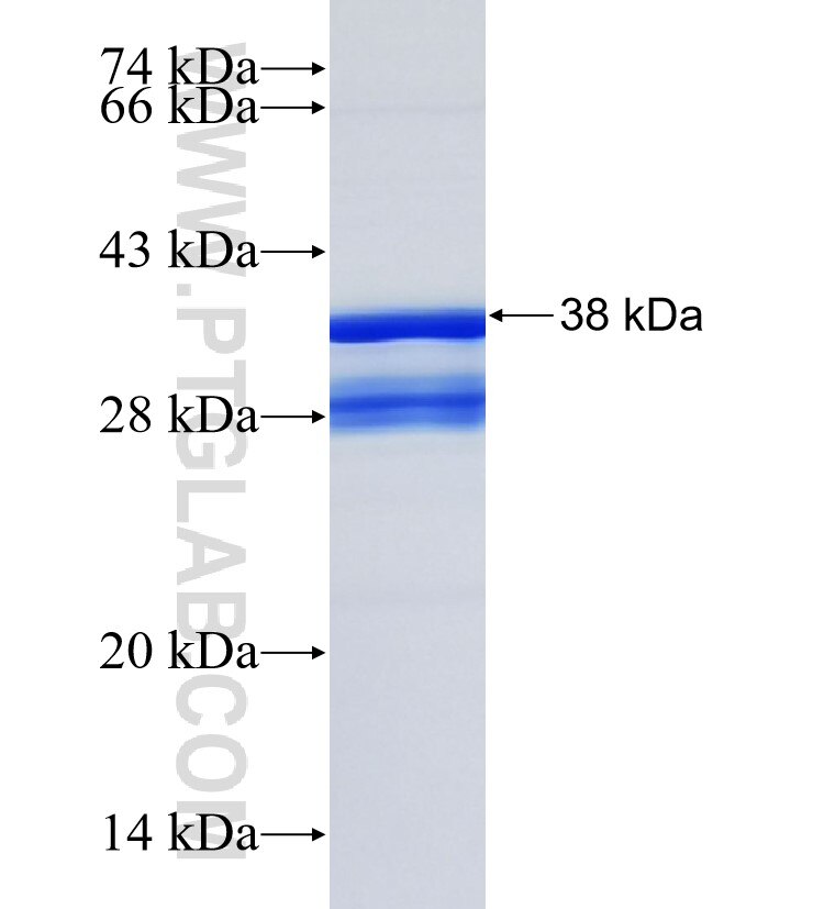CNIH3 fusion protein Ag3648 SDS-PAGE