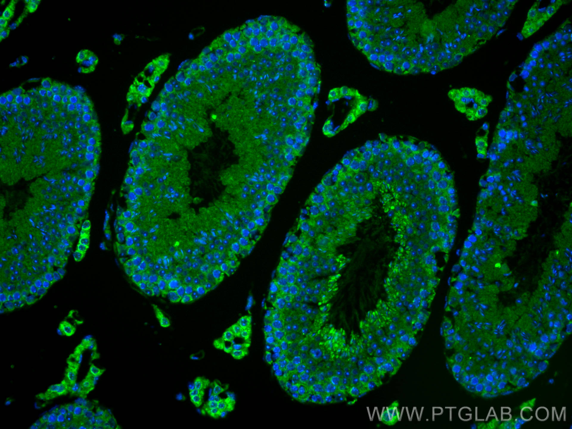 Immunofluorescence (IF) / fluorescent staining of mouse testis tissue using CNIH4 Polyclonal antibody (15015-1-AP)