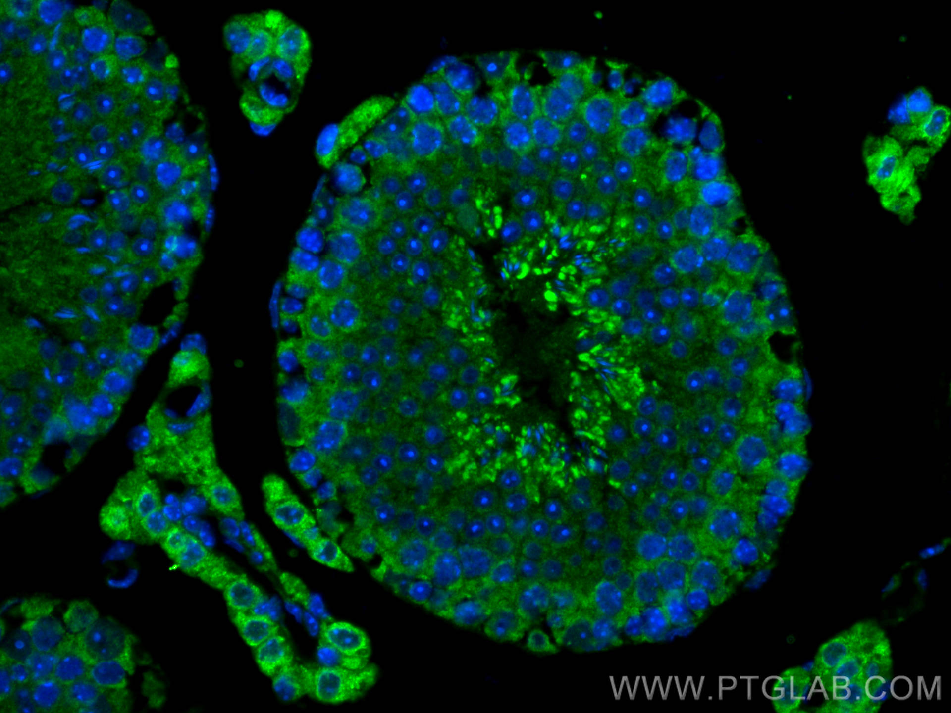 Immunofluorescence (IF) / fluorescent staining of mouse testis tissue using CNIH4 Polyclonal antibody (15015-1-AP)