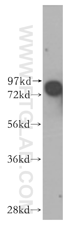 Western Blot (WB) analysis of human brain tissue using CNKSR1 Polyclonal antibody (10885-1-AP)