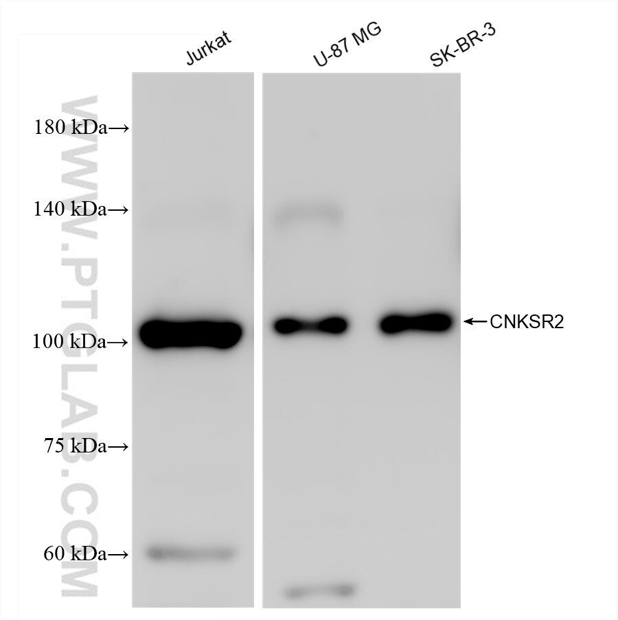 Western Blot (WB) analysis of various lysates using CNKSR2 Recombinant antibody (83354-3-RR)