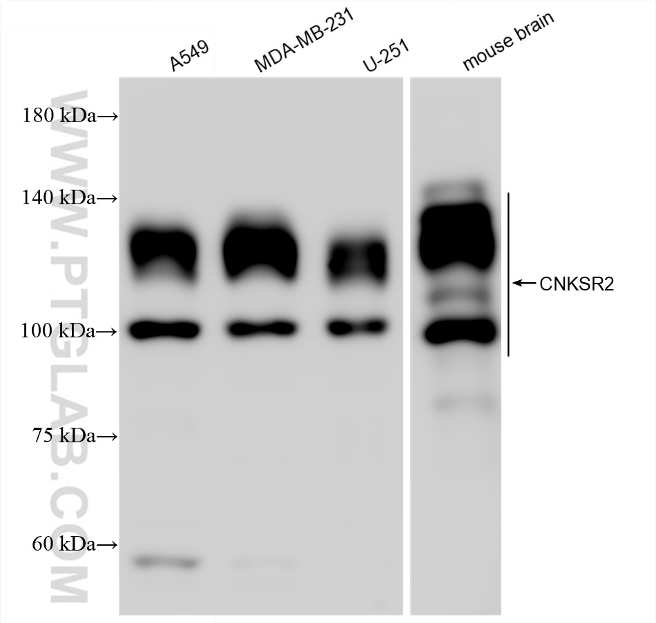 Western Blot (WB) analysis of various lysates using CNKSR2 Recombinant antibody (83354-3-RR)