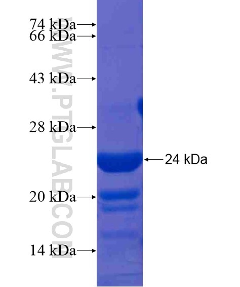 CNKSR2 fusion protein Ag21183 SDS-PAGE