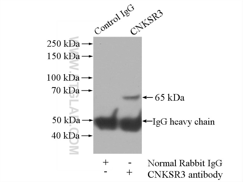 Immunoprecipitation (IP) experiment of mouse brain tissue using CNKSR3 Polyclonal antibody (14084-1-AP)