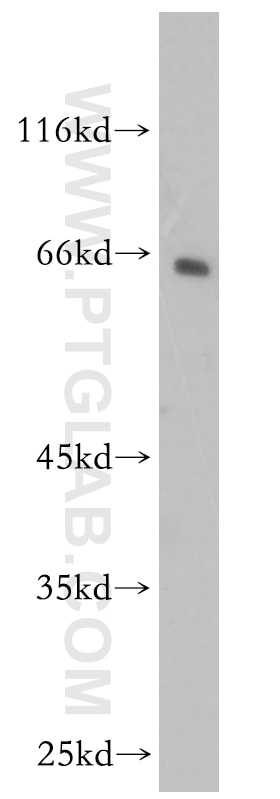 Western Blot (WB) analysis of human brain tissue using CNKSR3 Polyclonal antibody (14084-1-AP)