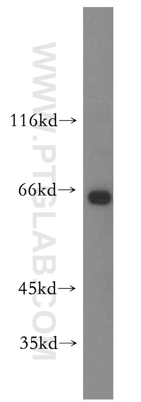 Western Blot (WB) analysis of mouse brain tissue using CNKSR3 Polyclonal antibody (14084-1-AP)