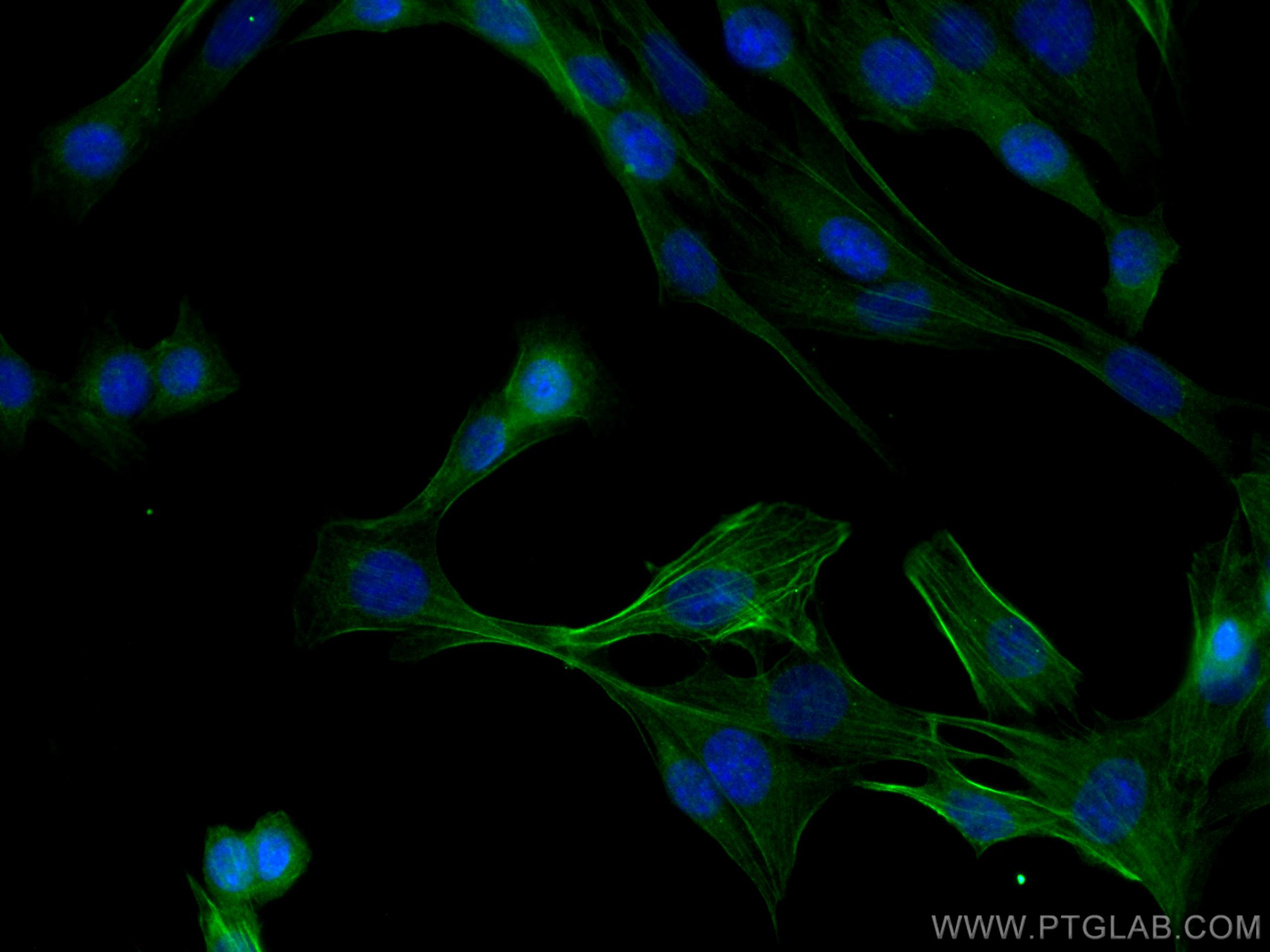 Immunofluorescence (IF) / fluorescent staining of C2C12 cells using Calponin Polyclonal antibody (13938-1-AP)