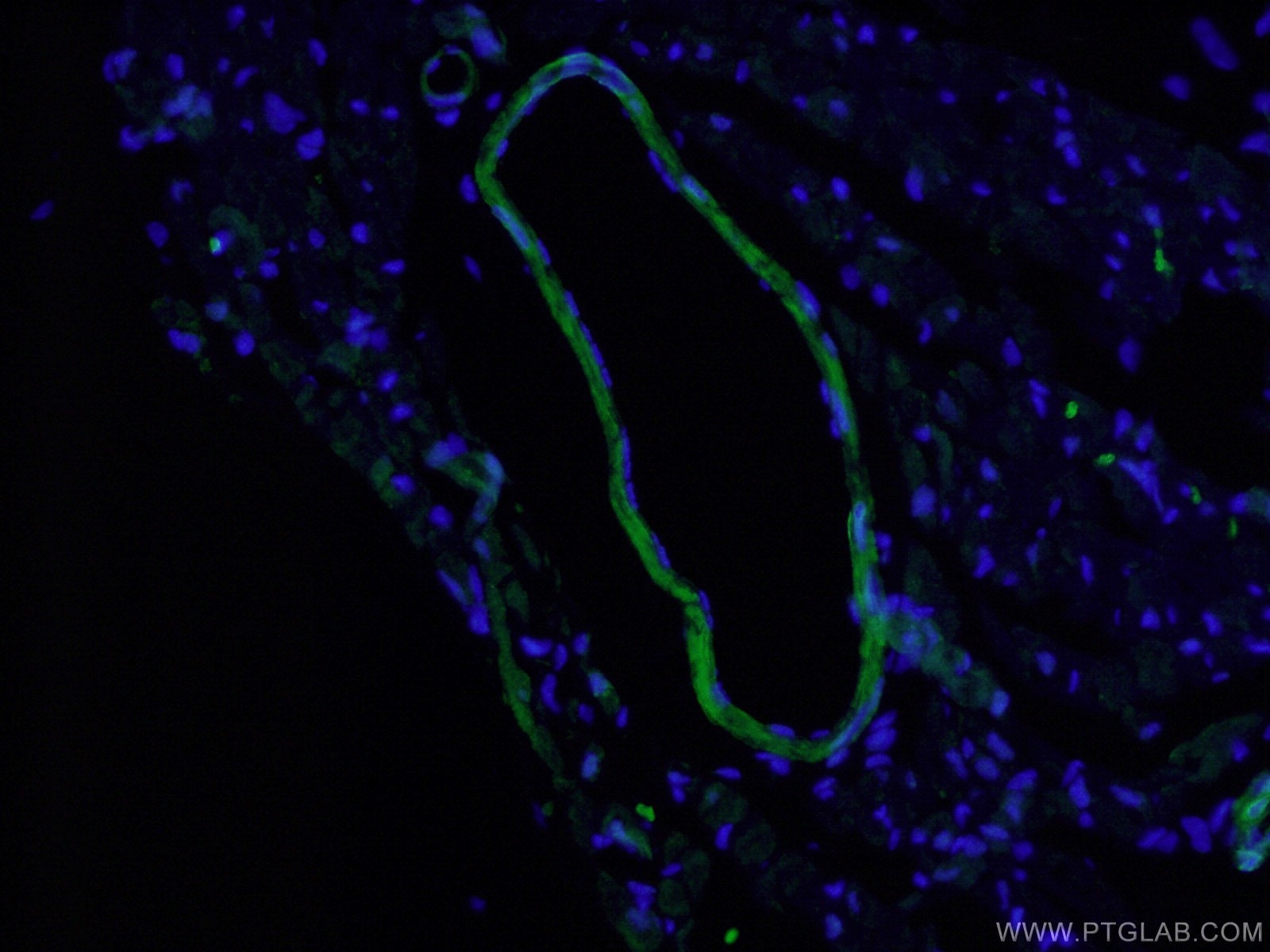 Immunofluorescence (IF) / fluorescent staining of mouse heart tissue using Calponin Polyclonal antibody (13938-1-AP)