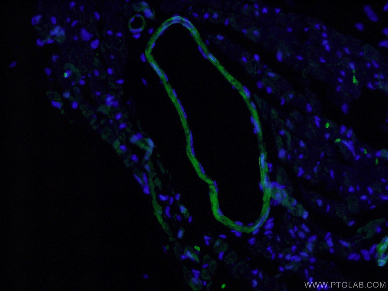 IF Staining of mouse heart using 13938-1-AP