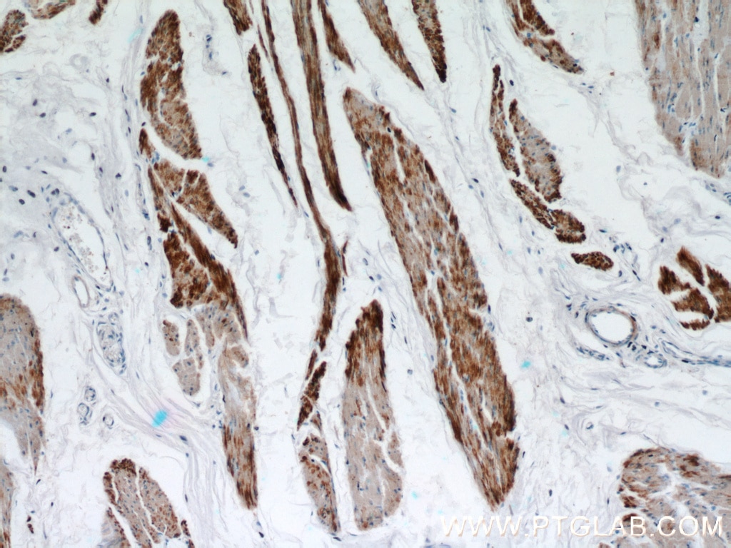 Immunohistochemistry (IHC) staining of human bladder tissue using Calponin Polyclonal antibody (13938-1-AP)