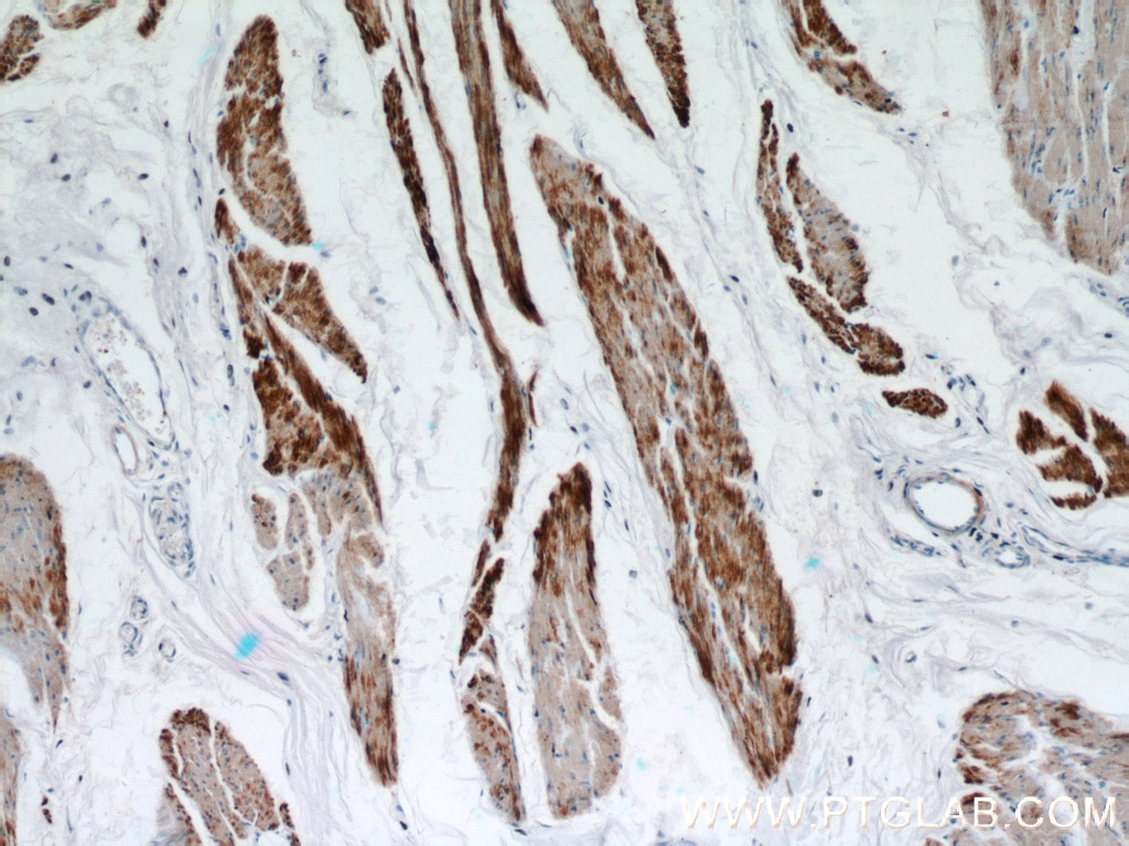 IHC staining of human bladder using 13938-1-AP