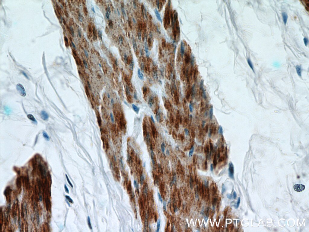 Immunohistochemistry (IHC) staining of human bladder tissue using Calponin Polyclonal antibody (13938-1-AP)