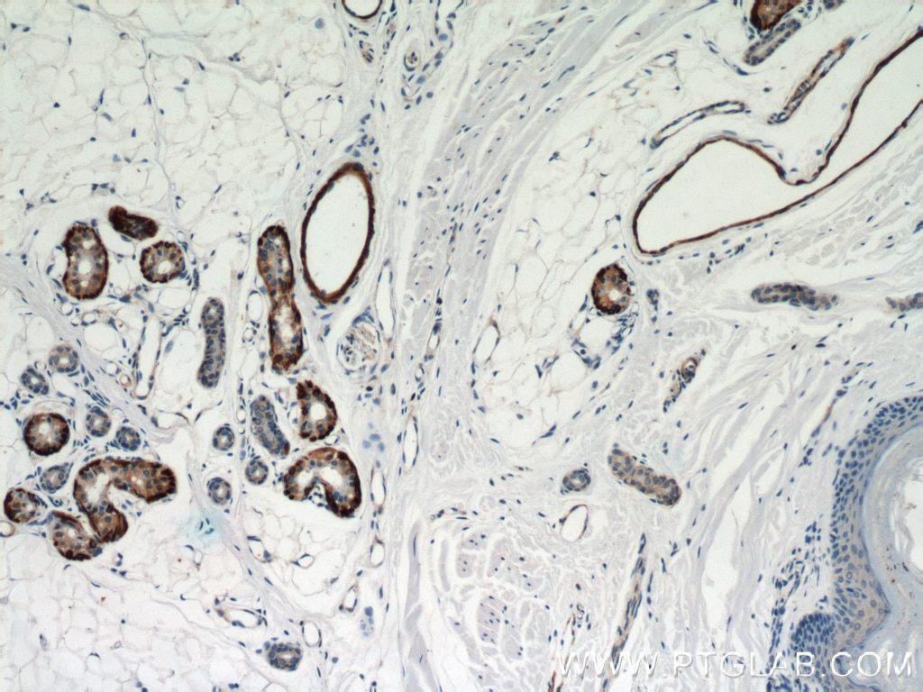 Immunohistochemistry (IHC) staining of human skin tissue using Calponin Polyclonal antibody (13938-1-AP)