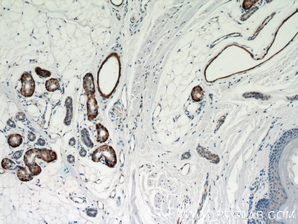 IHC staining of human skin using 13938-1-AP