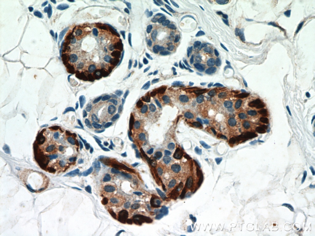 IHC staining of human skin using 13938-1-AP