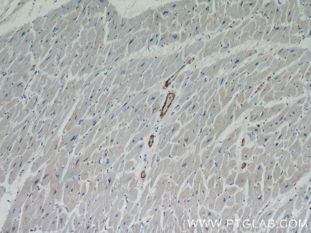 Immunohistochemistry (IHC) staining of human heart tissue using Calponin Polyclonal antibody (13938-1-AP)