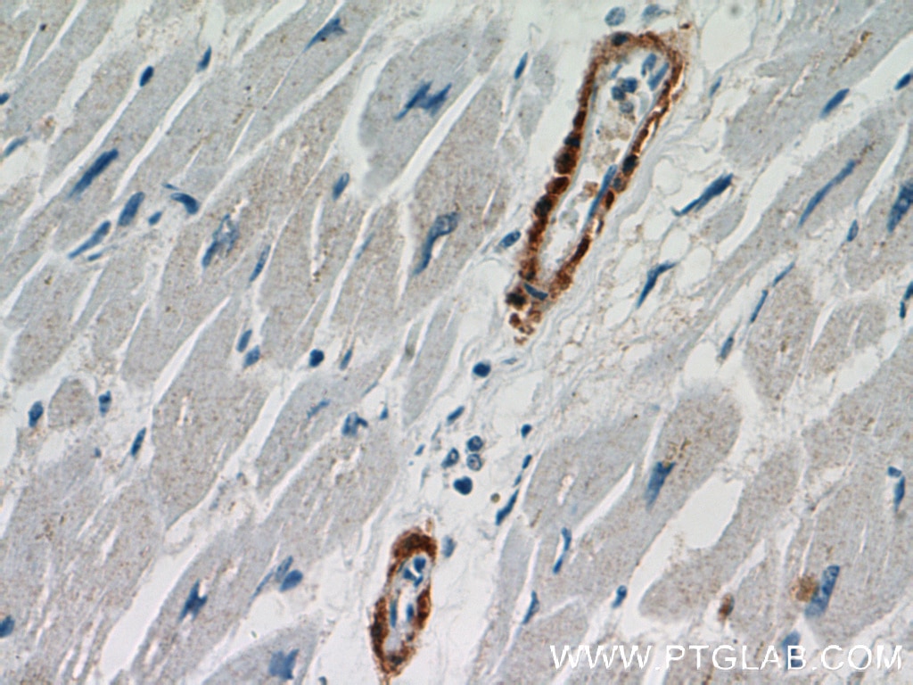 Immunohistochemistry (IHC) staining of human heart tissue using Calponin Polyclonal antibody (13938-1-AP)