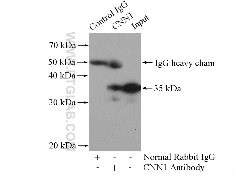 Immunoprecipitation (IP) experiment of mouse lung tissue using Calponin Polyclonal antibody (13938-1-AP)