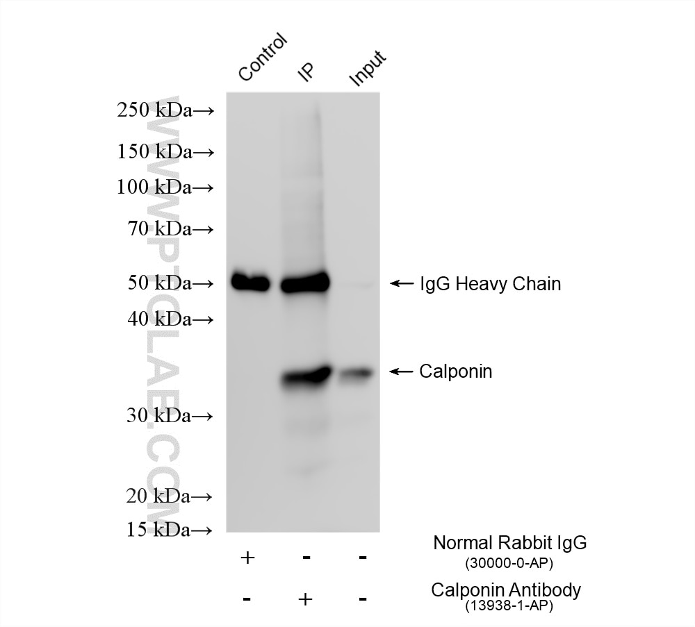 IP experiment of mouse heart using 13938-1-AP Immunoprecipitation (IP) experiment of mouse heart tissue using Calponin Polyclonal antibody (13938-1-AP)