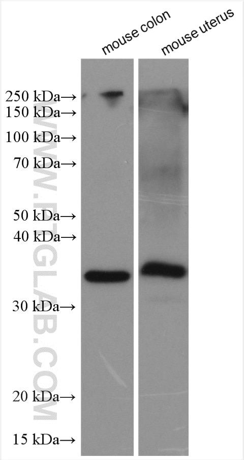 Western Blot (WB) analysis of various lysates using Calponin Polyclonal antibody (13938-1-AP)