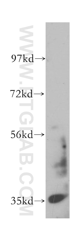 Western Blot (WB) analysis of mouse lung tissue using Calponin Polyclonal antibody (13938-1-AP)