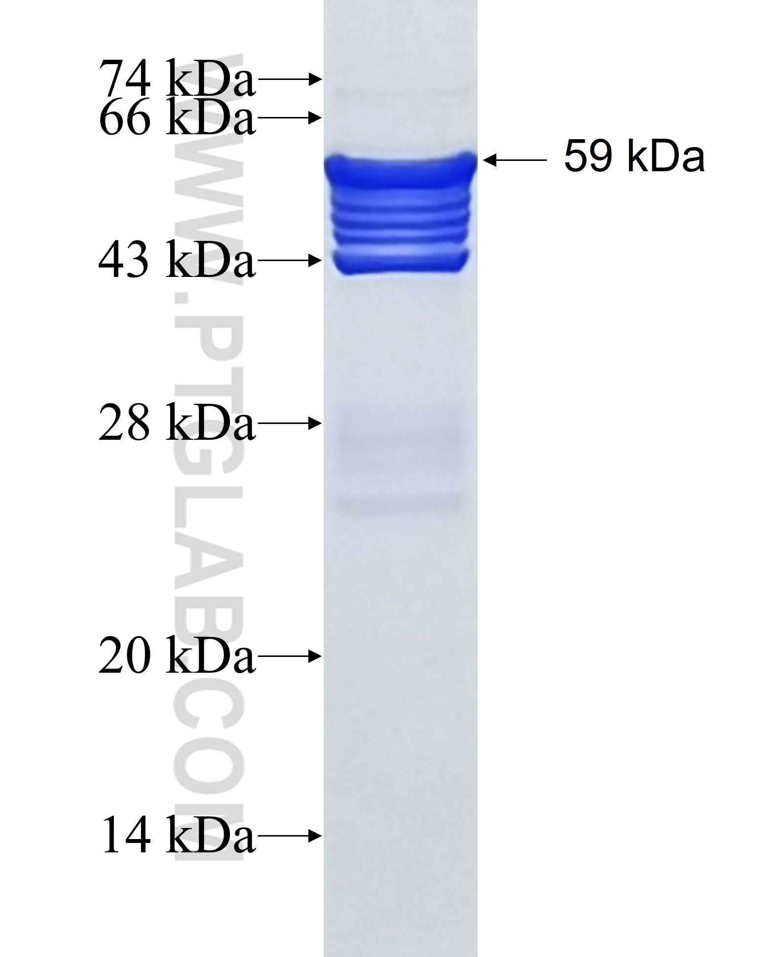 Calponin fusion protein Ag4989 SDS-PAGE