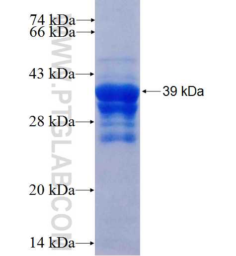 Calponin fusion protein Ag5177 SDS-PAGE
