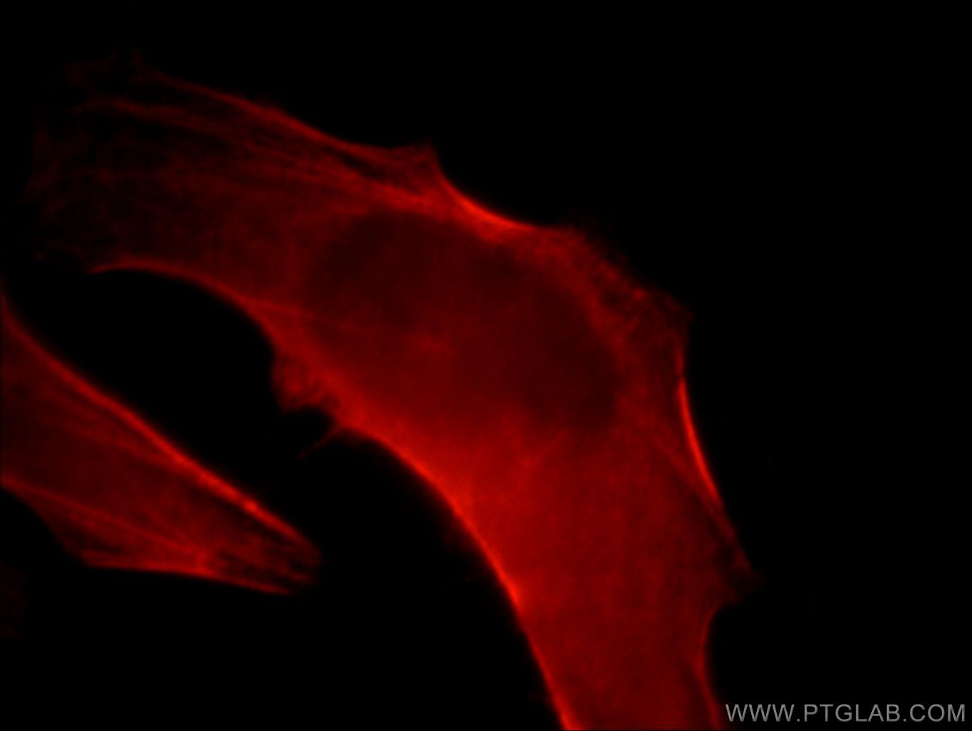 Immunofluorescence (IF) / fluorescent staining of HeLa cells using CNN2 Polyclonal antibody (21073-1-AP)