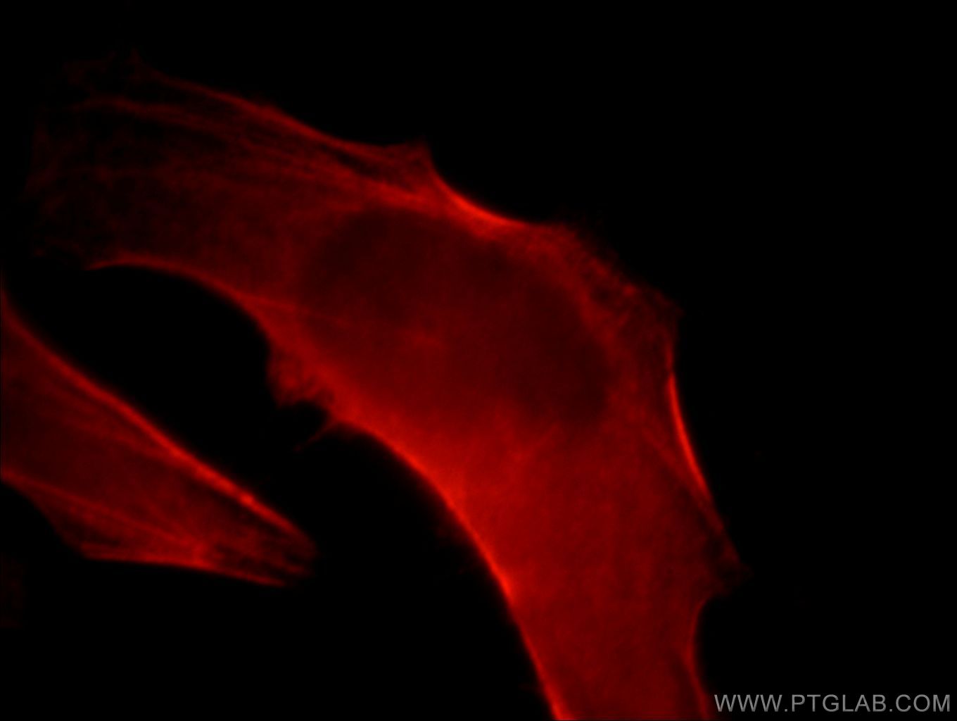 IF Staining of HeLa using 21073-1-AP