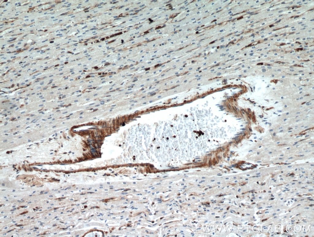 Immunohistochemistry (IHC) staining of human heart tissue using CNN2 Polyclonal antibody (21073-1-AP)