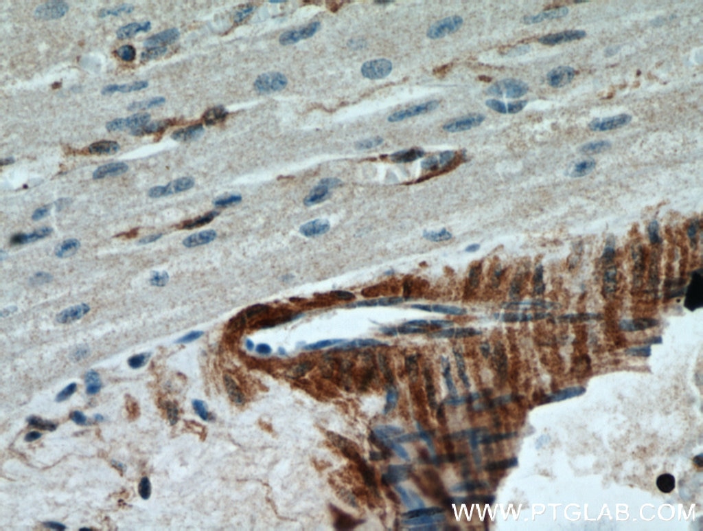 Immunohistochemistry (IHC) staining of human heart tissue using CNN2 Polyclonal antibody (21073-1-AP)