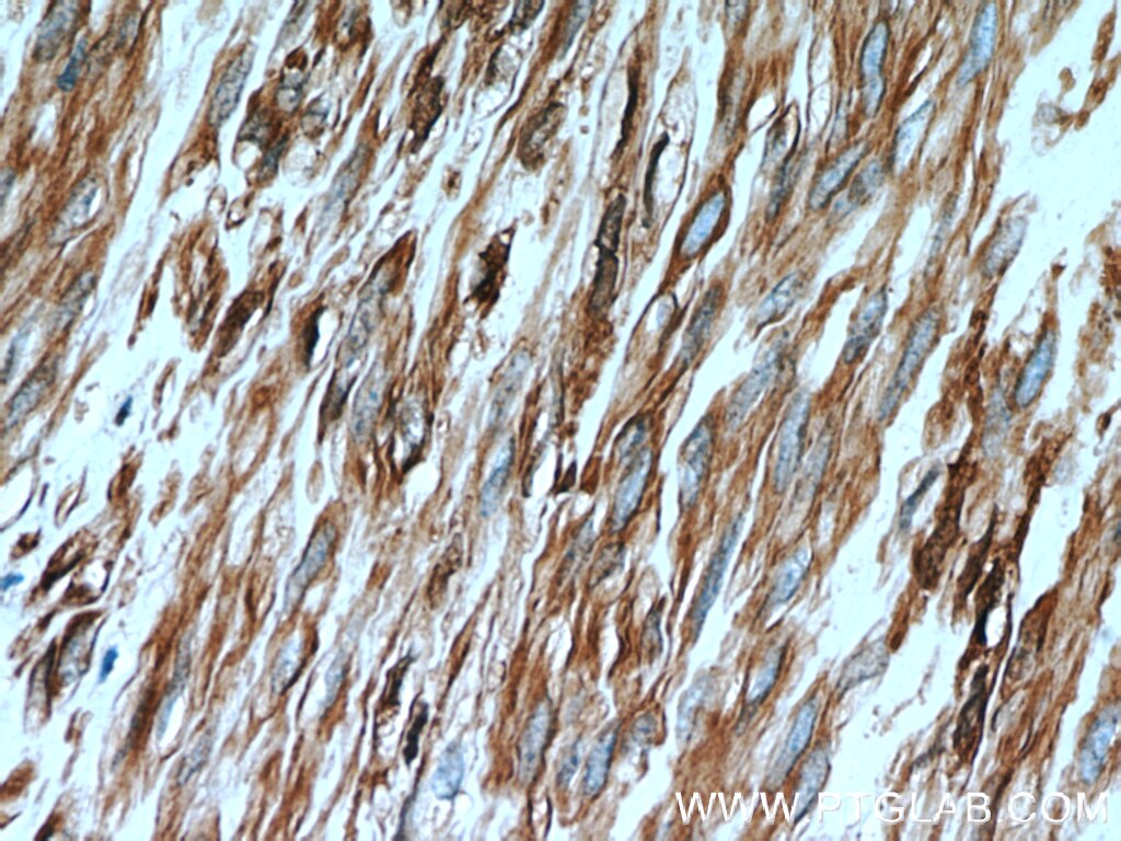 Immunohistochemistry (IHC) staining of human hysteromyoma tissue using CNN2 Polyclonal antibody (21073-1-AP)