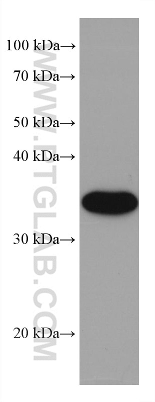 WB analysis of HeLa using 66244-1-Ig