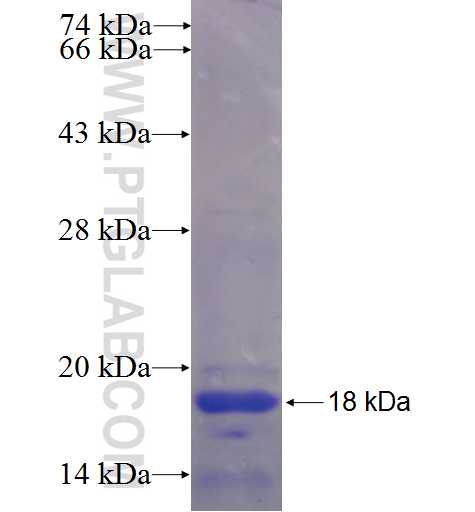 CNN2 fusion protein Ag23594 SDS-PAGE