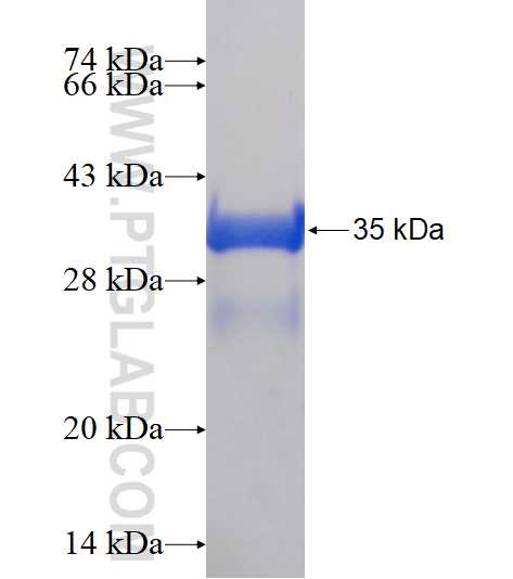 CNN2 fusion protein Ag15225 SDS-PAGE