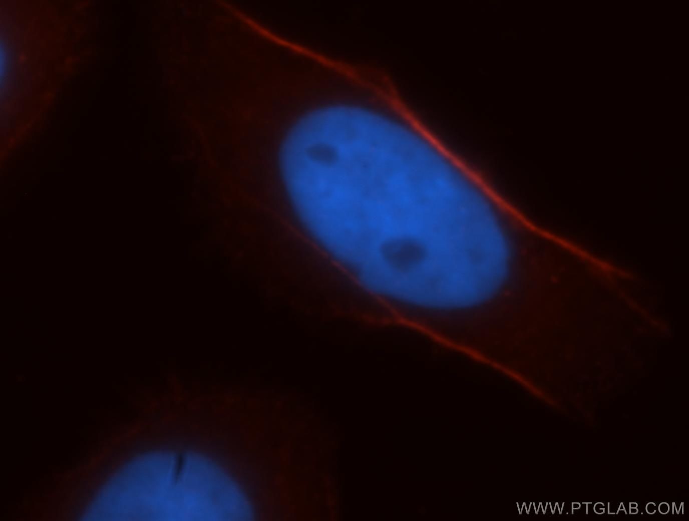 Immunofluorescence (IF) / fluorescent staining of HeLa cells using CNN3 Polyclonal antibody (11509-1-AP)