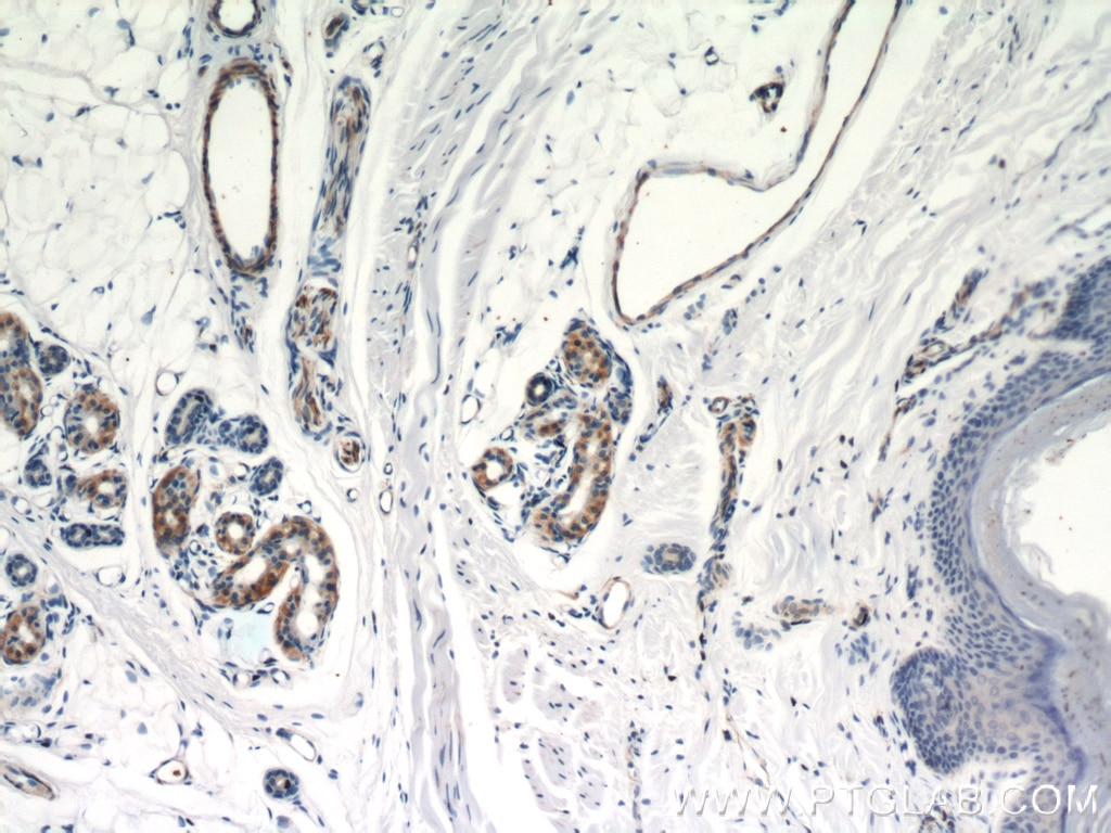 Immunohistochemistry (IHC) staining of human skin tissue using CNN3 Polyclonal antibody (11509-1-AP)